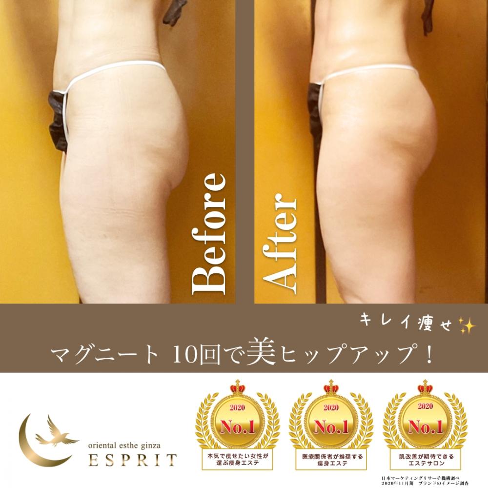 人気の4大痩身エステコースのビフォーアフターをご紹介!