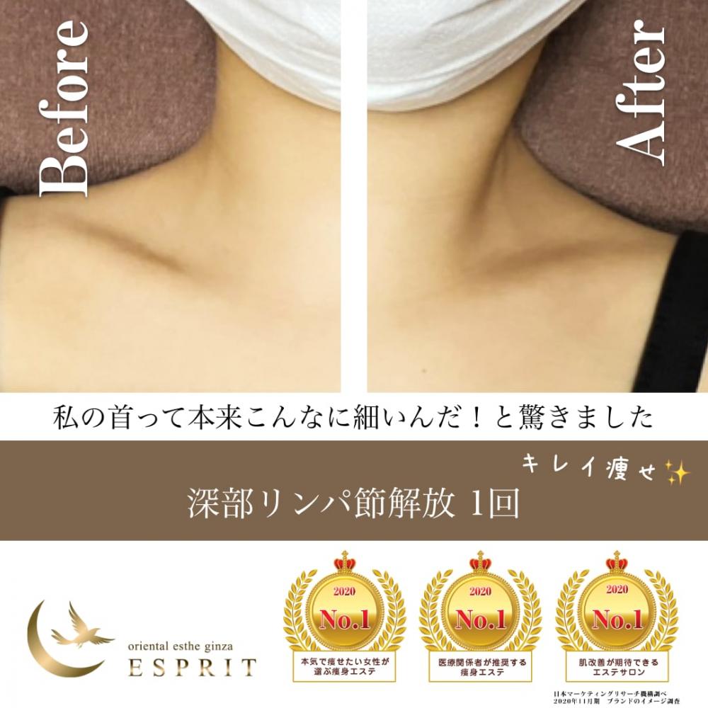 人気の4大痩身エステコースのビフォーアフターをご紹介!