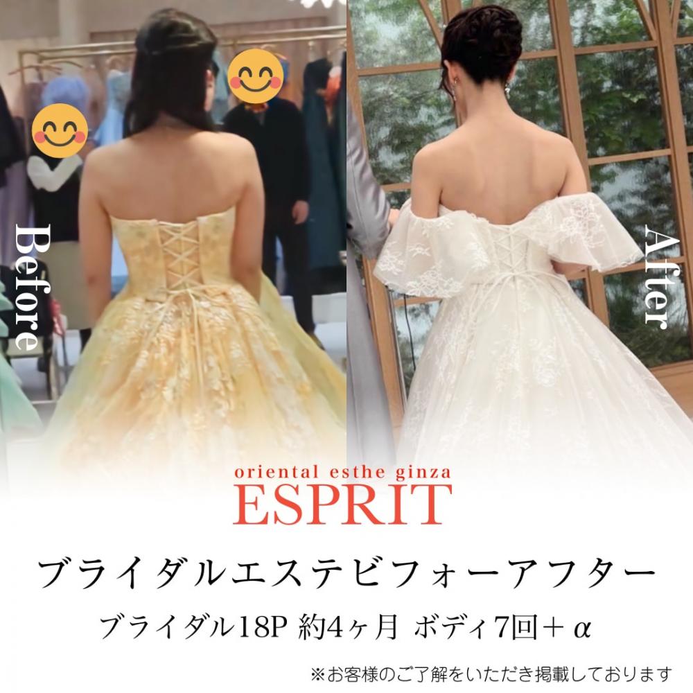 銀座・新宿の人気ブライダルエステ|エスプリで叶える“理想の花嫁姿”