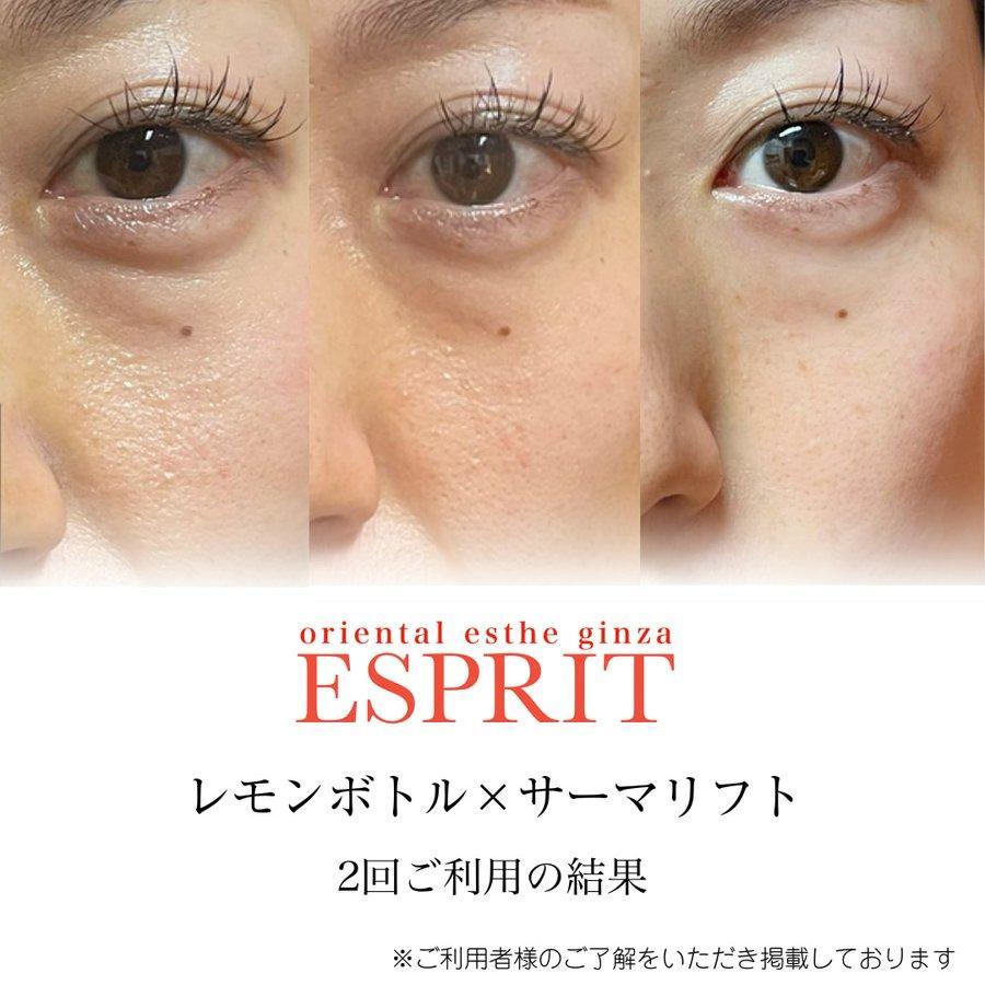 ほうれい線・二重あご・目の下のたるみ…老け顔の原因と対策｜小顔＆老け顔ケアで若々しい印象へ