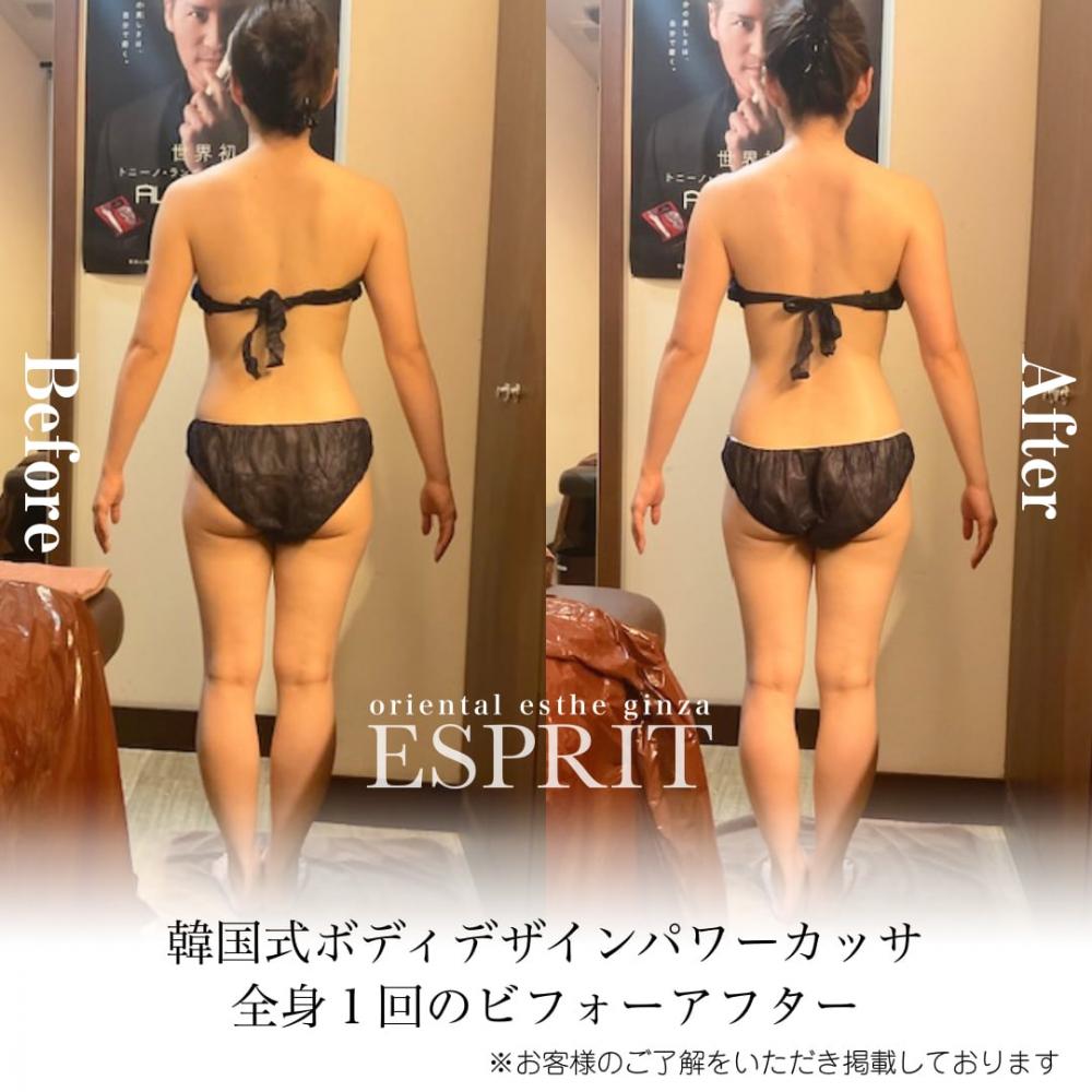 2024年10月の痩身&肌改善(肌管理)エステコースのビフォーアフターをご紹介!