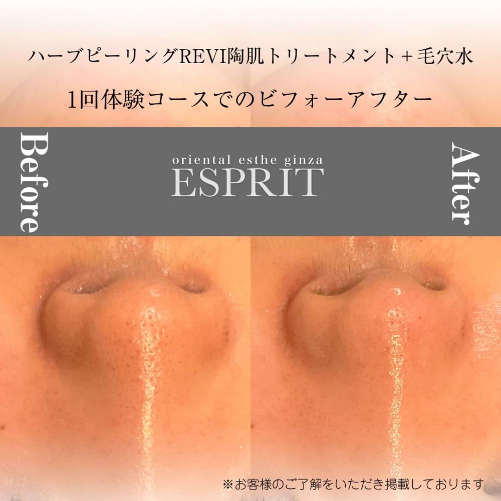 2024年10月の痩身&肌改善(肌管理)エステコースのビフォーアフターをご紹介!