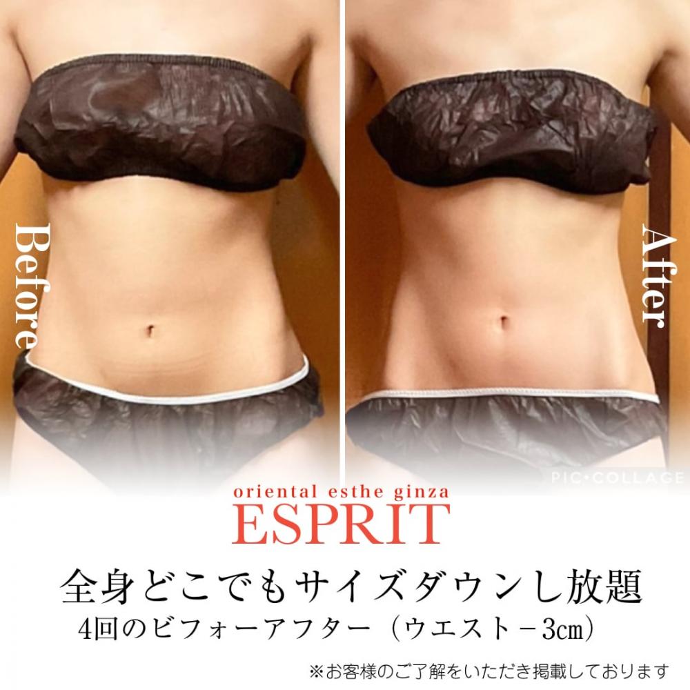 【初心者必見】痩身エステは本当に効果がある?おすすめコースとビフォーアフターも公開!