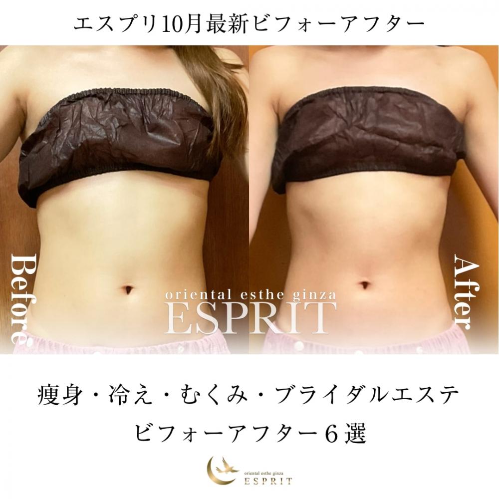 【ビフォーアフター画像あり】2025年10月|痩身・冷え・むくみ・ブライダルエステ事例6選!