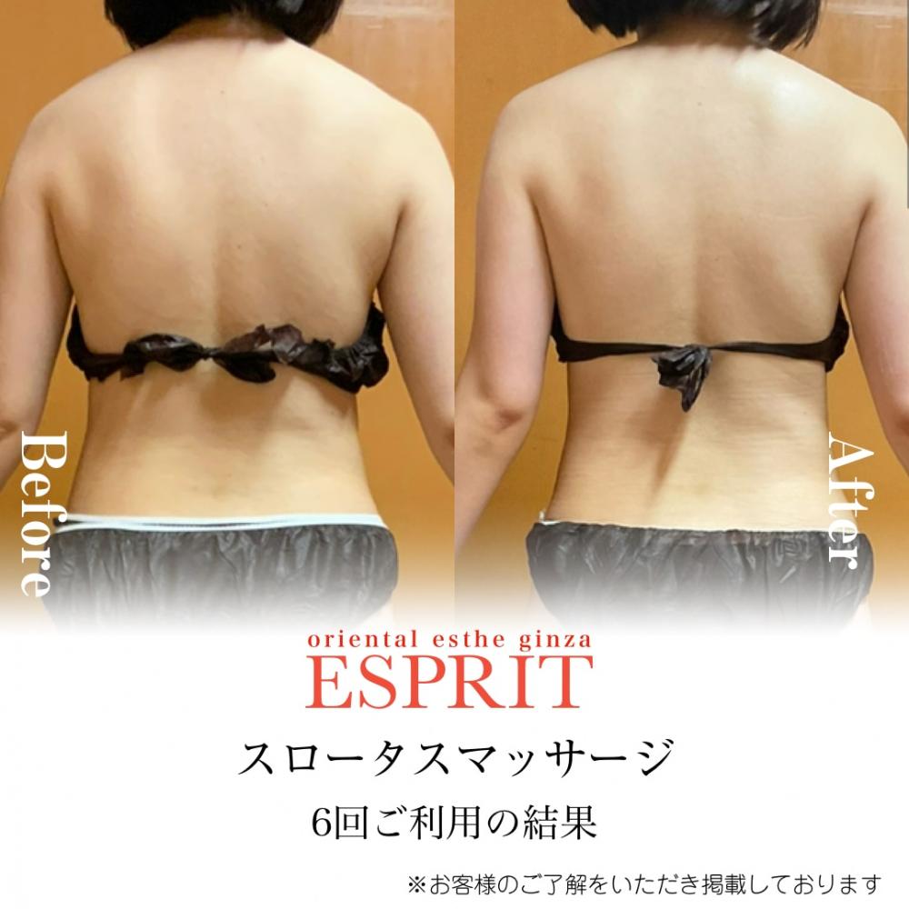 【ビフォーアフター画像あり】2025年10月|痩身・冷え・むくみ・ブライダルエステ事例6選!