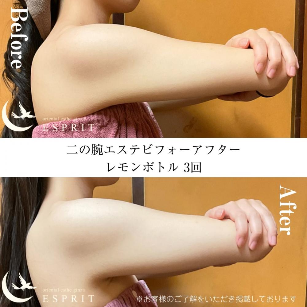 【ビフォーアフター画像あり】2025年10月|痩身・冷え・むくみ・ブライダルエステ事例6選!