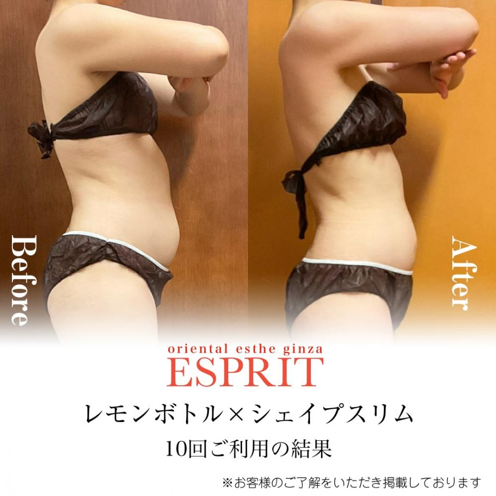 【ビフォーアフター画像あり】2025年10月|痩身・冷え・むくみ・ブライダルエステ事例6選!