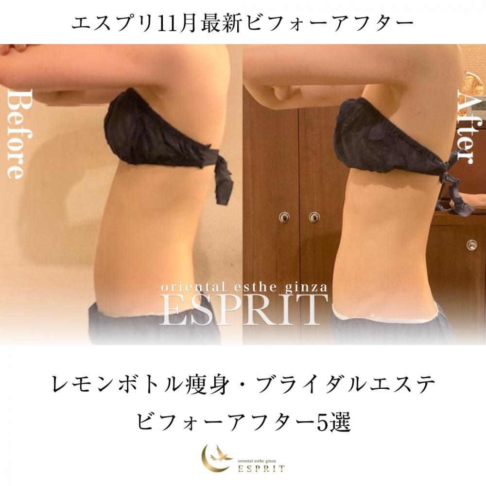 【レモンボトル痩身・ブライダルエステ】2025年11月ビフォーアフター5選|銀座・新宿エスプリ