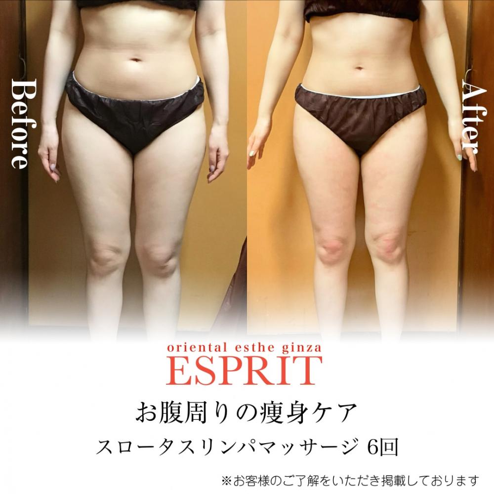 【レモンボトル痩身・ブライダルエステ】2025年11月ビフォーアフター5選|銀座・新宿エスプリ