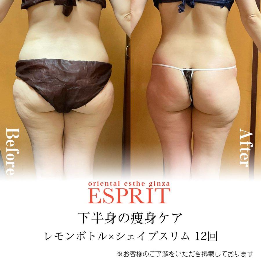 【レモンボトル痩身・ブライダルエステ】2025年11月ビフォーアフター5選|銀座・新宿エスプリ