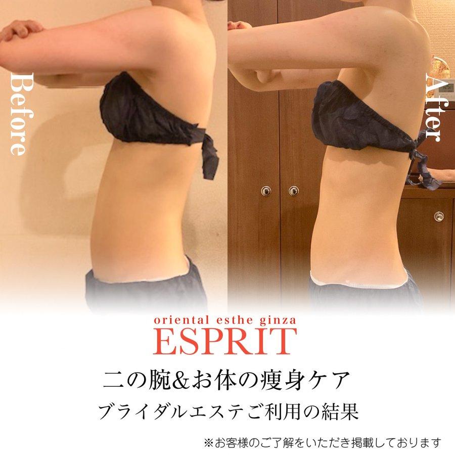 【レモンボトル痩身・ブライダルエステ】2025年11月ビフォーアフター5選|銀座・新宿エスプリ