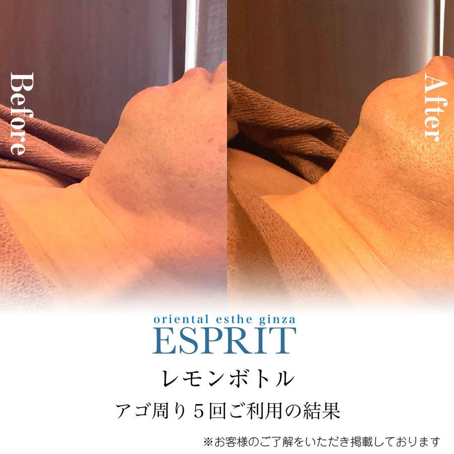 【レモンボトル痩身・ブライダルエステ】2025年11月ビフォーアフター5選|銀座・新宿エスプリ