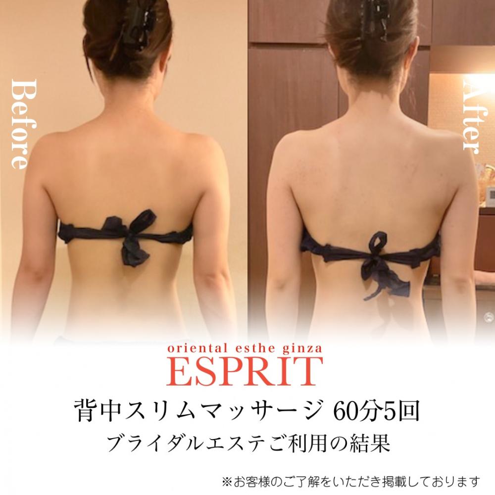 【20代｜ブライダル痩身 2ヶ月】