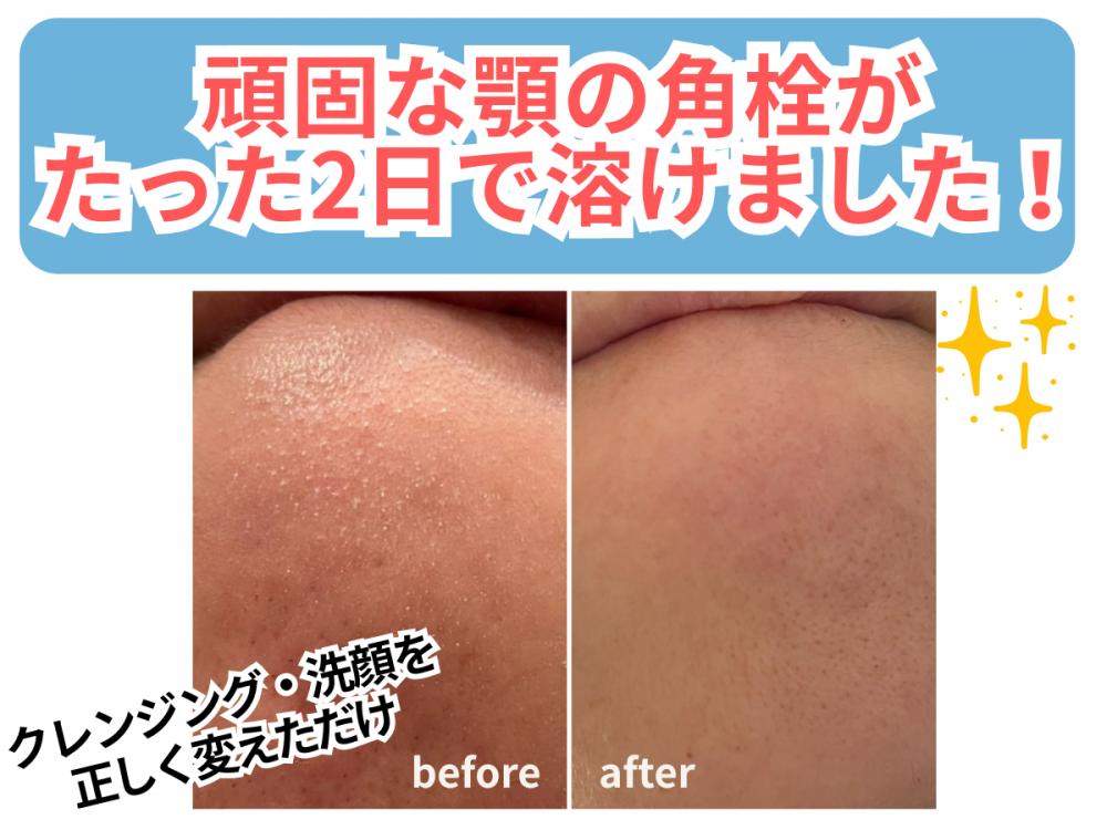 クレンジングの仕方ひとつで肌は変わる｜エステサロンが教える正しい洗顔とクレンジングレッスン