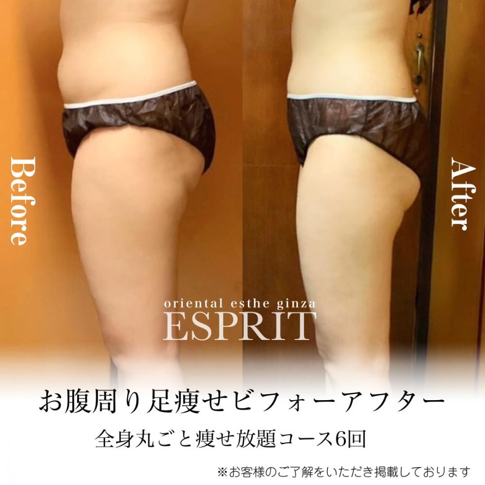 2024年12月の痩身&肌改善(肌管理)エステコースのビフォーアフターをご紹介!