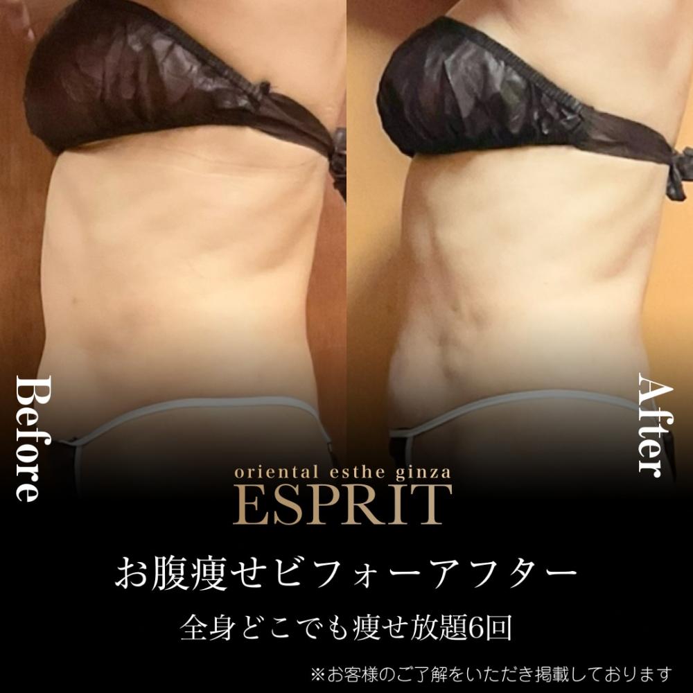 2024年12月の痩身&肌改善(肌管理)エステコースのビフォーアフターをご紹介!