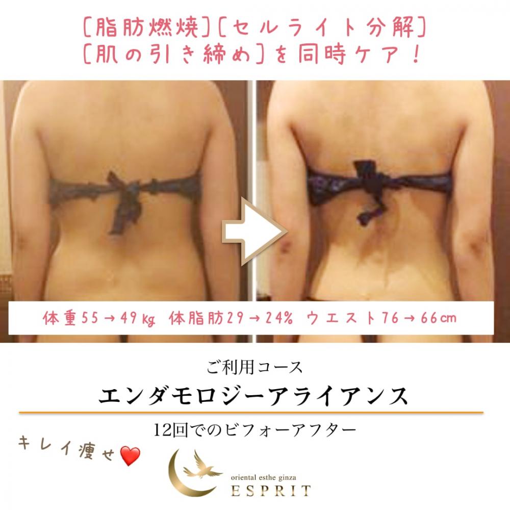キレイ痩せ!ボディラインを変える!エンダモロジーアライアンスのビフォーアフター!