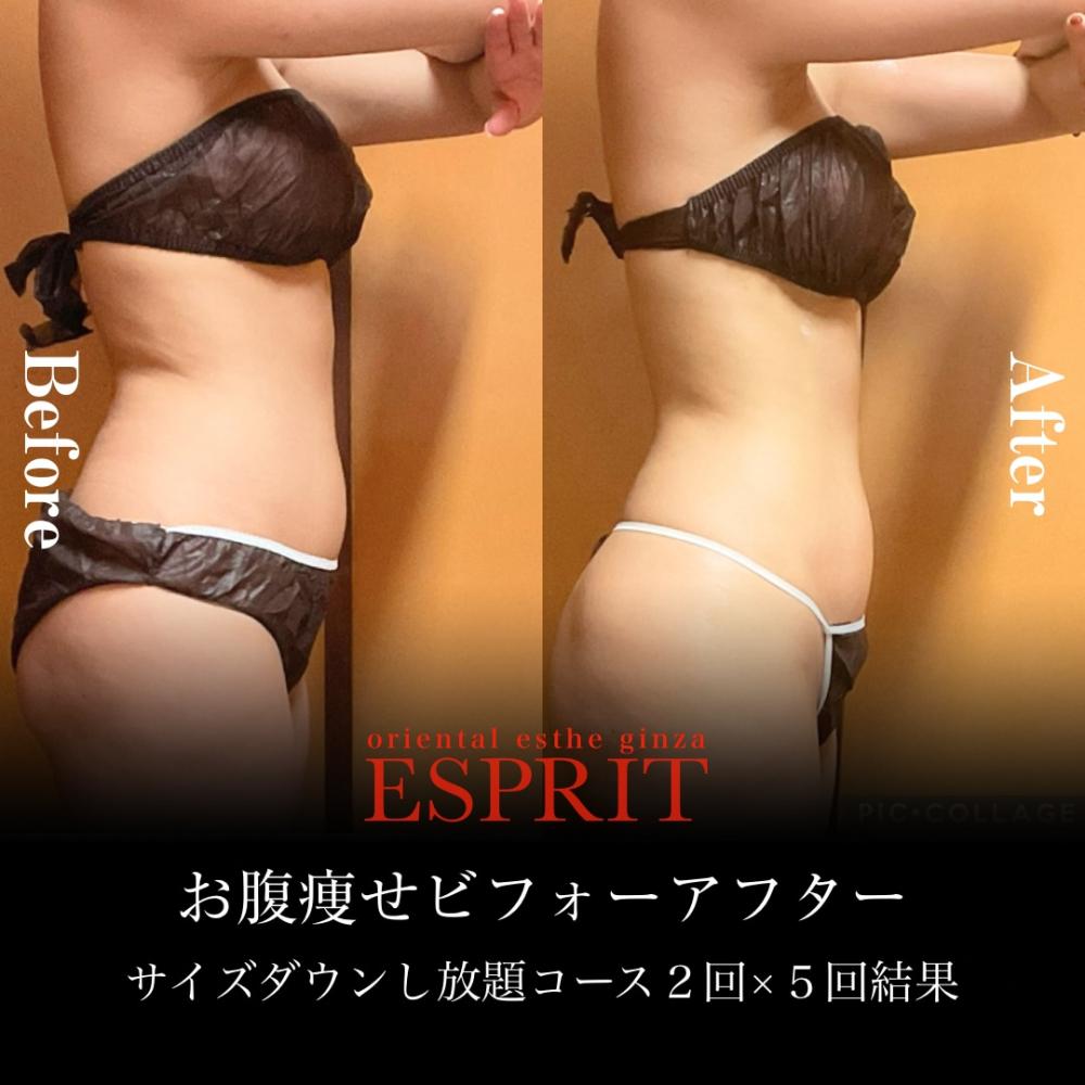 2024年11月の痩身&肌改善(肌管理)エステコースのビフォーアフターをご紹介!