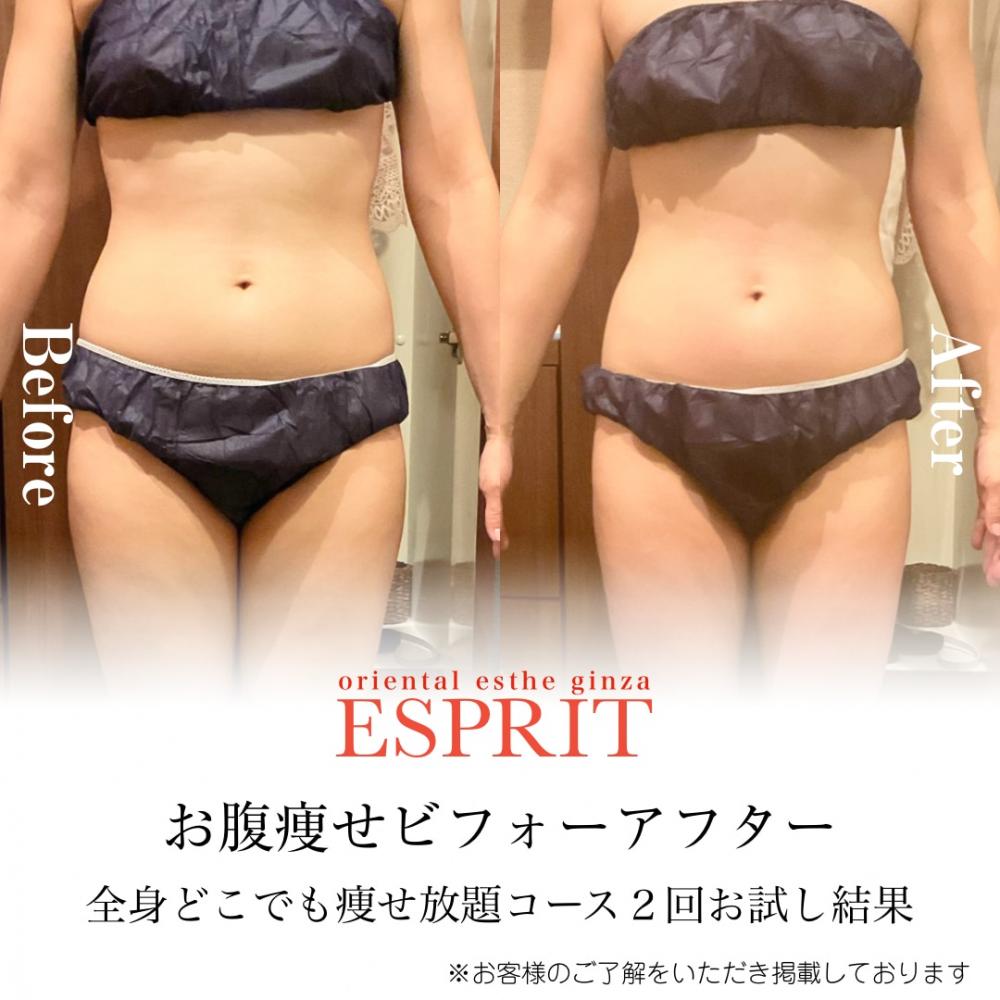 2024年11月の痩身&肌改善(肌管理)エステコースのビフォーアフターをご紹介!