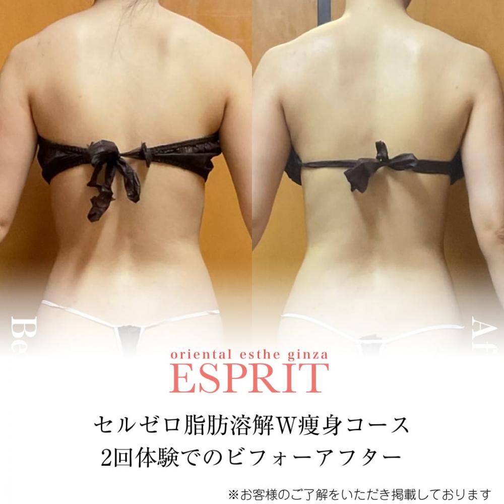 2024年1月の痩身&肌改善(肌管理)エステコースのビフォーアフターをご紹介!