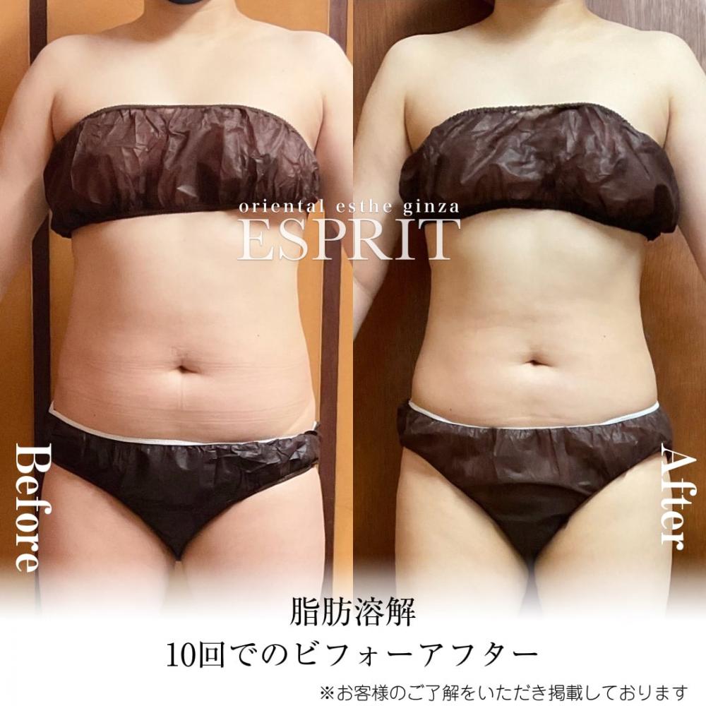 2024年1月の痩身&肌改善(肌管理)エステコースのビフォーアフターをご紹介!