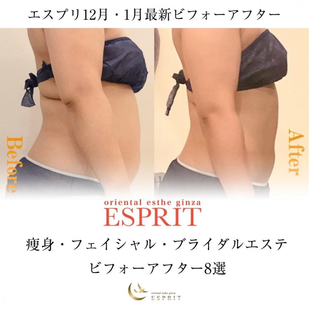 【痩身・肌改善の事例】2025年12月・2026年1月ビフォーアフター8選｜銀座・新宿エスプリ
