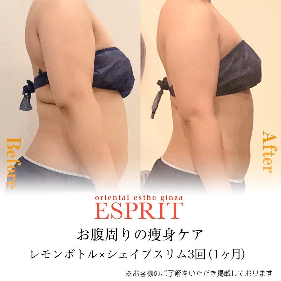 【痩身・肌改善の事例】2025年12月・2026年1月ビフォーアフター8選｜銀座・新宿エスプリ