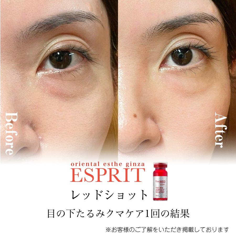 【痩身・肌改善の事例】2025年12月・2026年1月ビフォーアフター8選｜銀座・新宿エスプリ