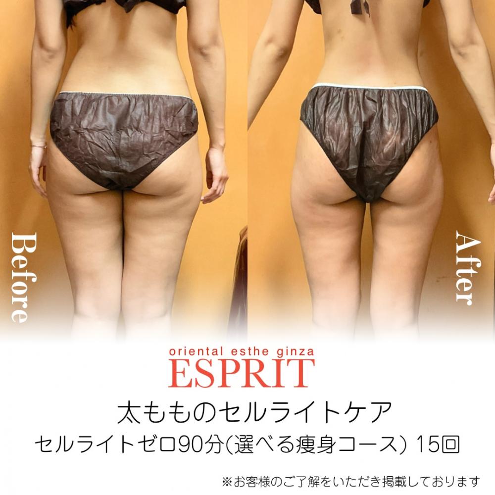 【痩身・肌改善の事例】2025年12月・2026年1月ビフォーアフター8選｜銀座・新宿エスプリ