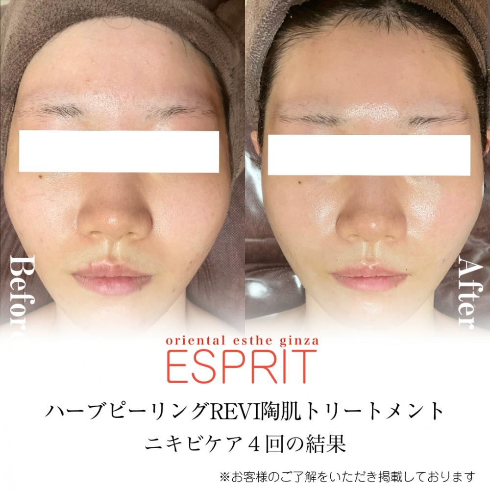 【痩身・肌改善の事例】2025年12月・2026年1月ビフォーアフター8選｜銀座・新宿エスプリ