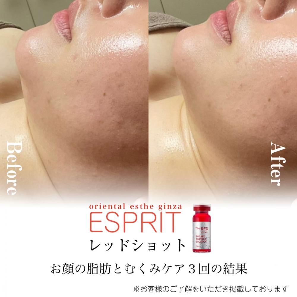 【痩身・肌改善の事例】2025年12月・2026年1月ビフォーアフター8選｜銀座・新宿エスプリ