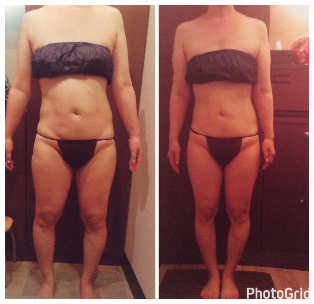 Before/After