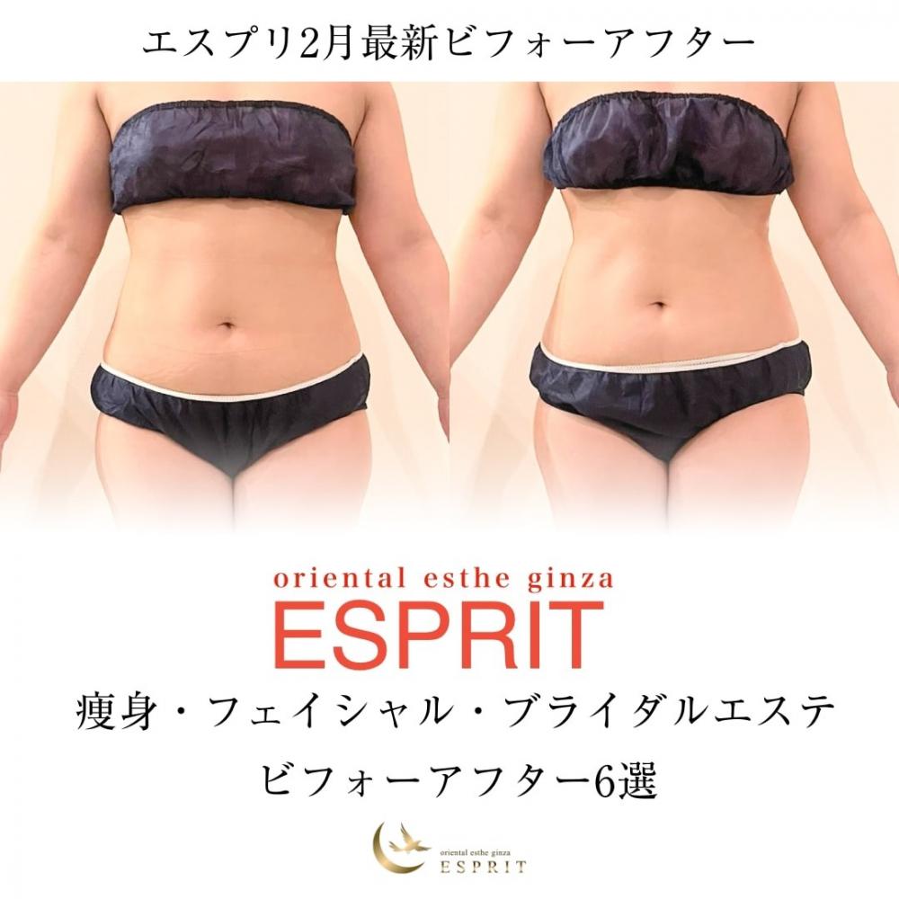 【痩身・小顔エステの事例】2026年2月ビフォーアフター｜銀座・新宿エスプリ