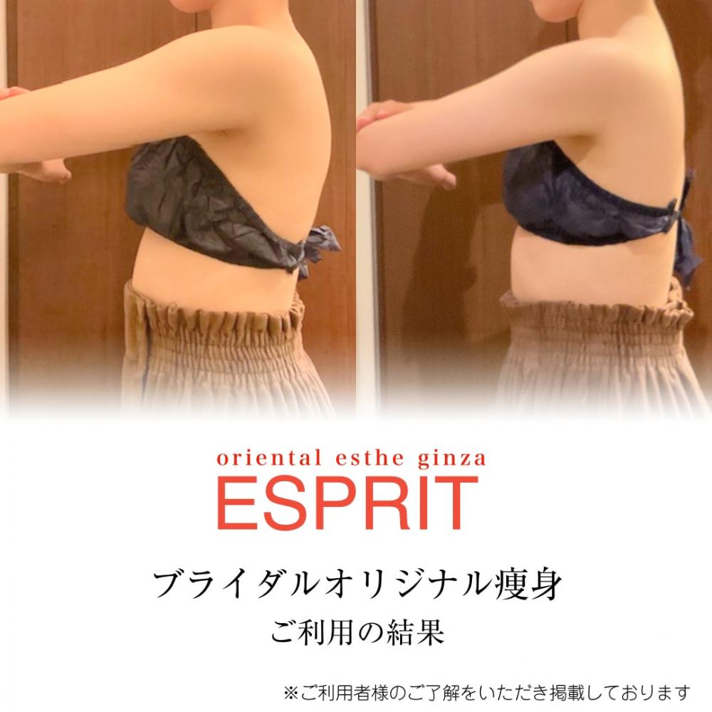 【痩身・小顔エステの事例】2026年2月ビフォーアフター｜銀座・新宿エスプリ