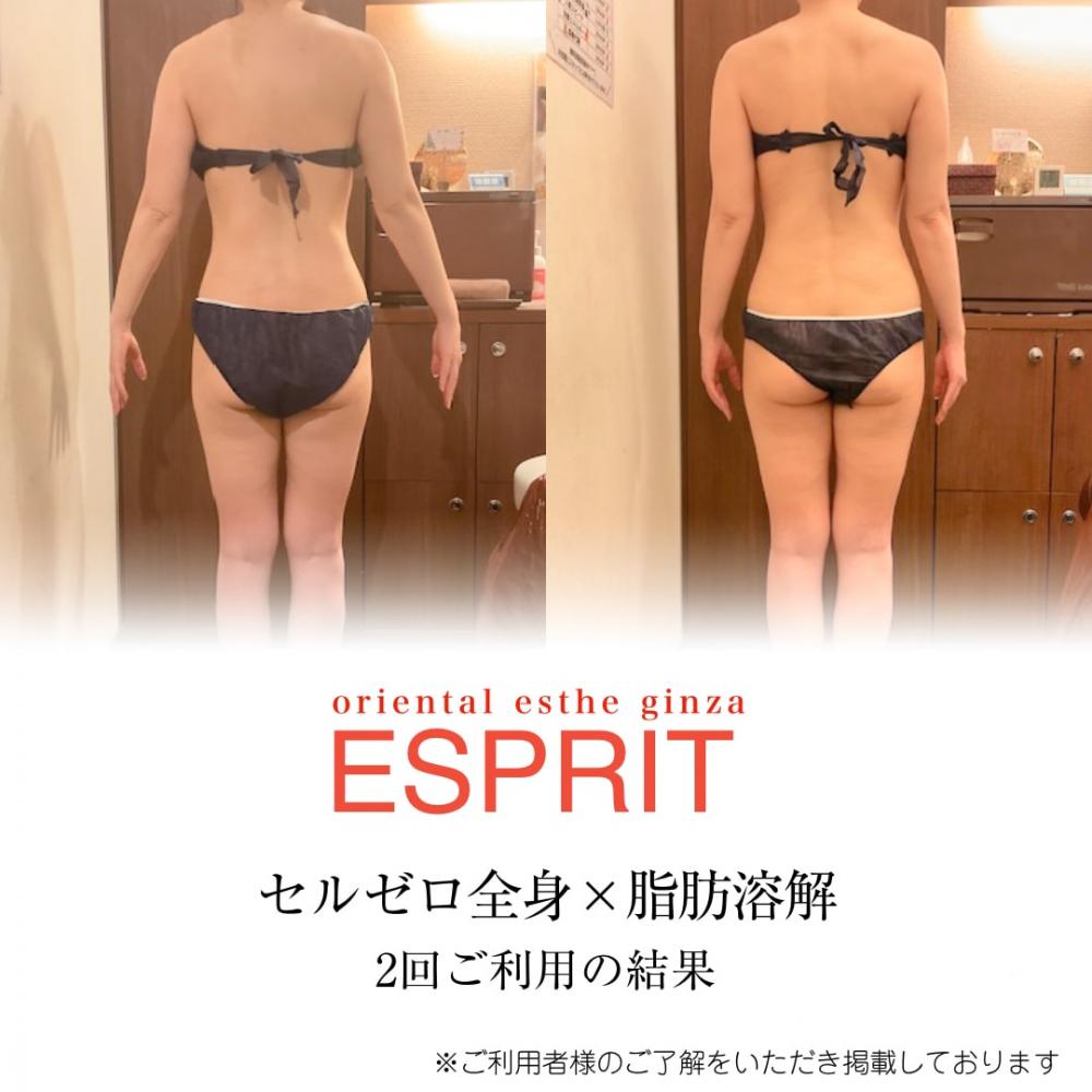 【痩身・小顔エステの事例】2026年2月ビフォーアフター｜銀座・新宿エスプリ