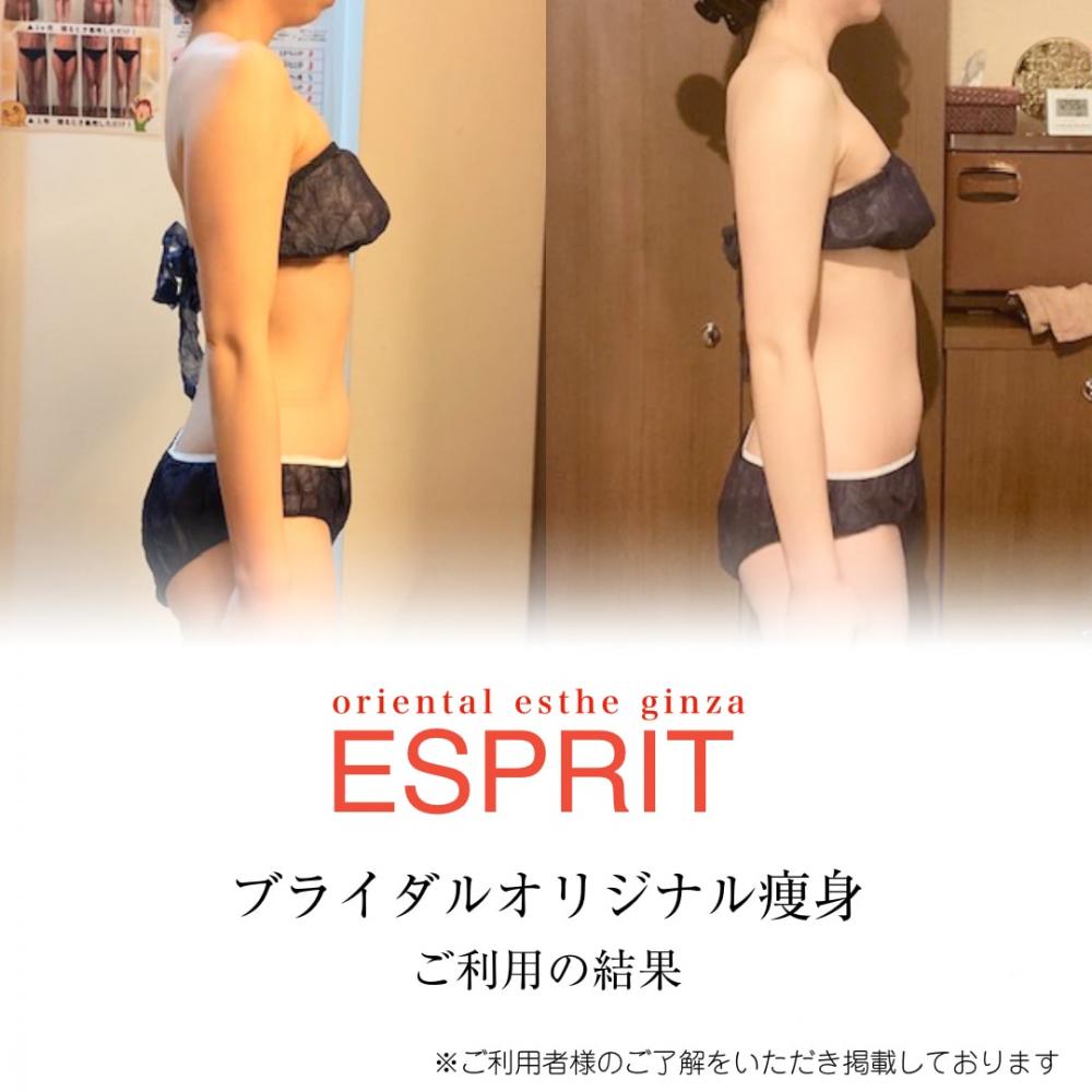 【痩身・小顔エステの事例】2026年2月ビフォーアフター｜銀座・新宿エスプリ