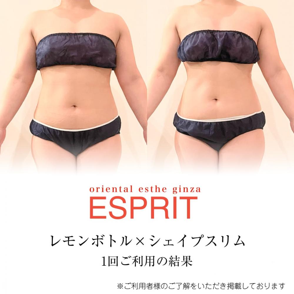 【痩身・小顔エステの事例】2026年2月ビフォーアフター｜銀座・新宿エスプリ