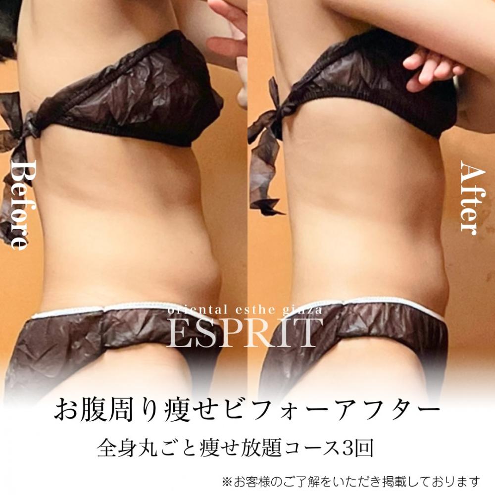 2025年2月の痩身&肌改善(肌管理)エステコースのビフォーアフターをご紹介!
