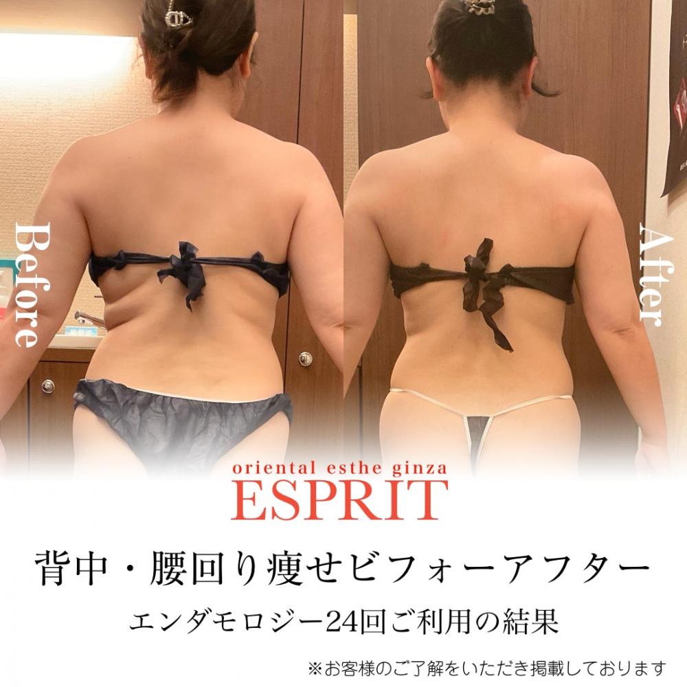 2025年2月の痩身&肌改善(肌管理)エステコースのビフォーアフターをご紹介!