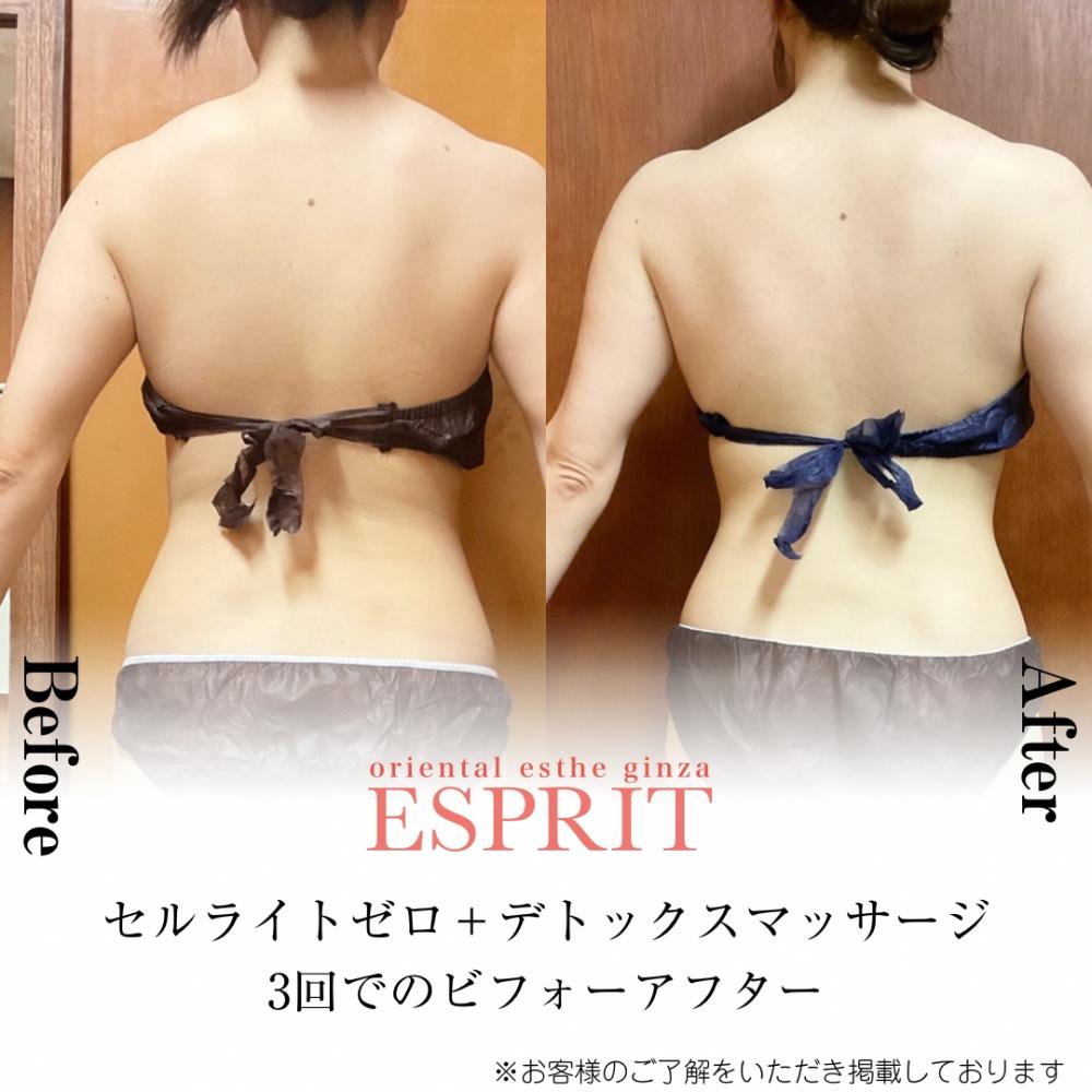 2024年2月の痩身&肌改善(肌管理)エステコースのビフォーアフターをご紹介!