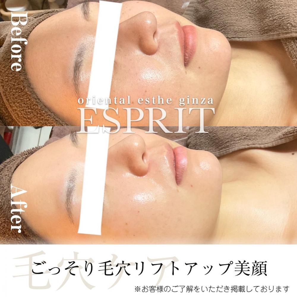 2024年2月の痩身&肌改善(肌管理)エステコースのビフォーアフターをご紹介!