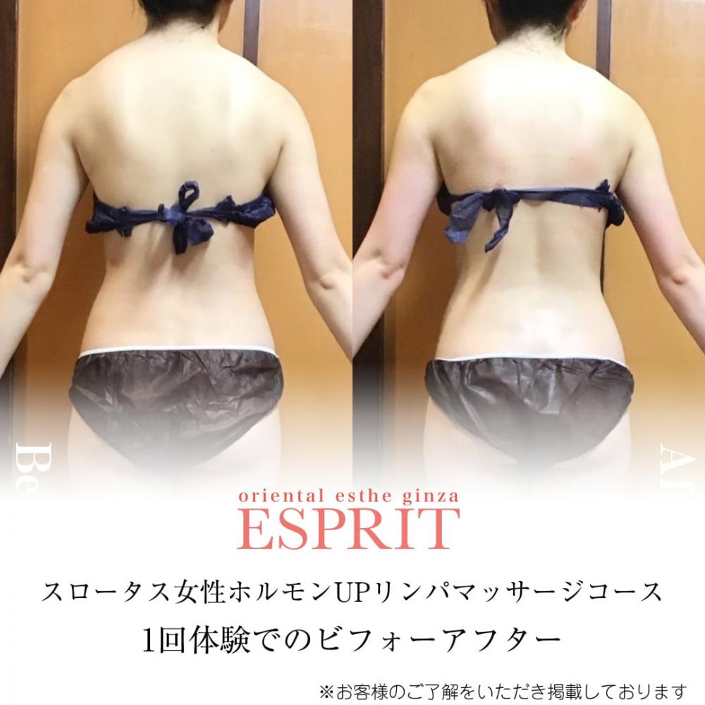 2024年2月の痩身&肌改善(肌管理)エステコースのビフォーアフターをご紹介!