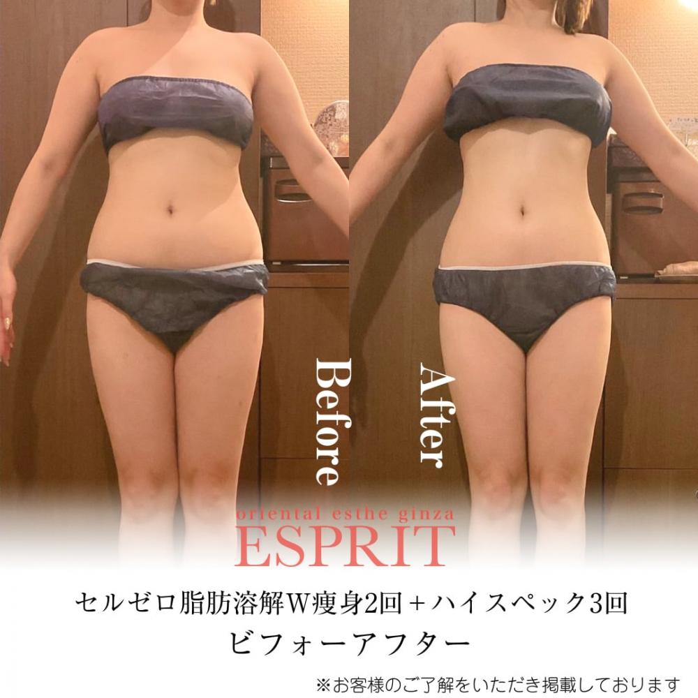 2024年2月の痩身&肌改善(肌管理)エステコースのビフォーアフターをご紹介!
