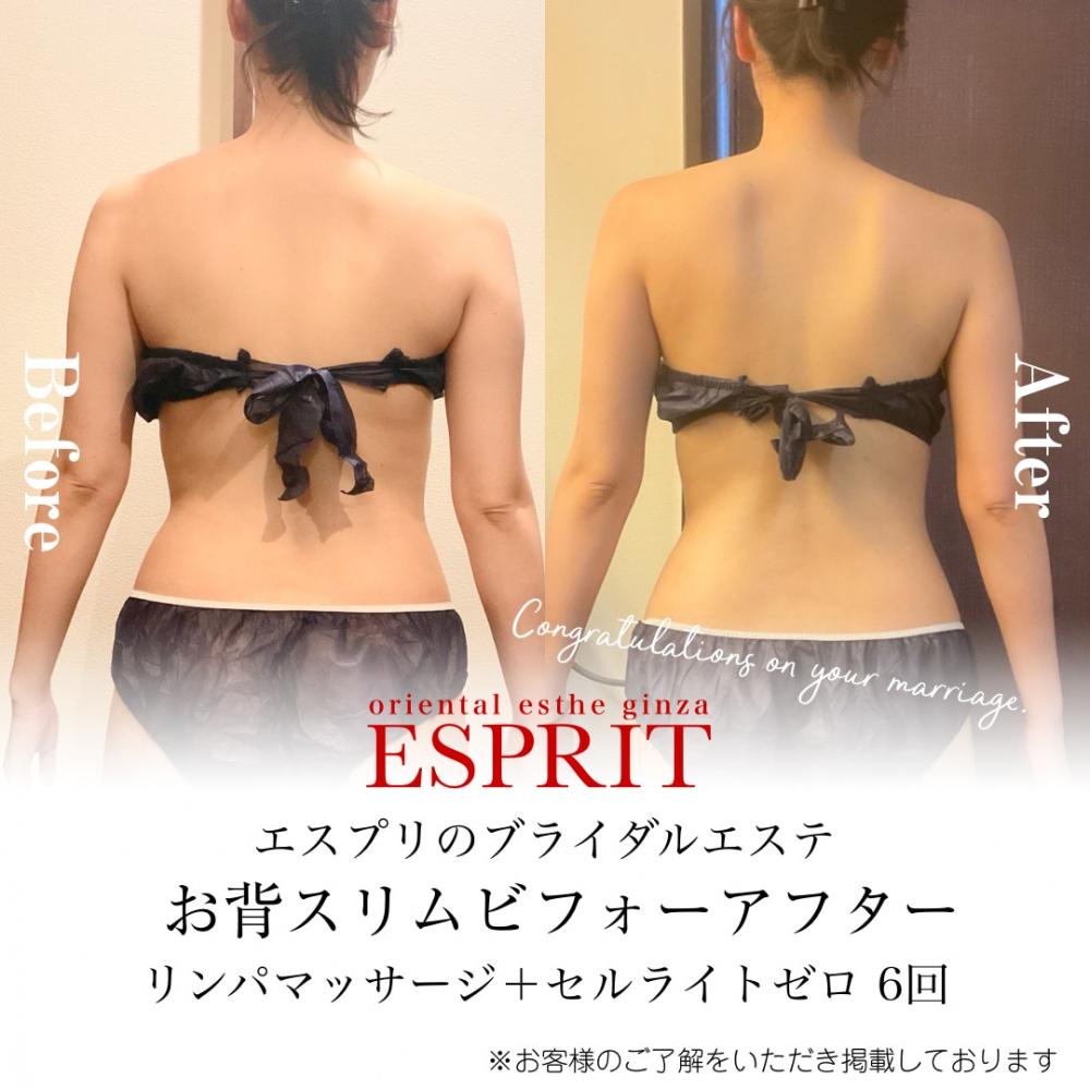 花嫁必見!フェイシャル・痩身・背中やせで叶える「理想の私」へ|ブライダルエステ完全ガイド