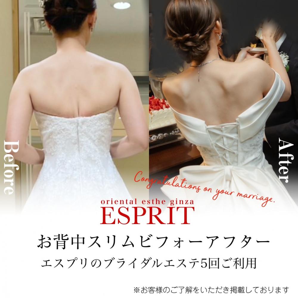 花嫁必見!フェイシャル・痩身・背中やせで叶える「理想の私」へ|ブライダルエステ完全ガイド