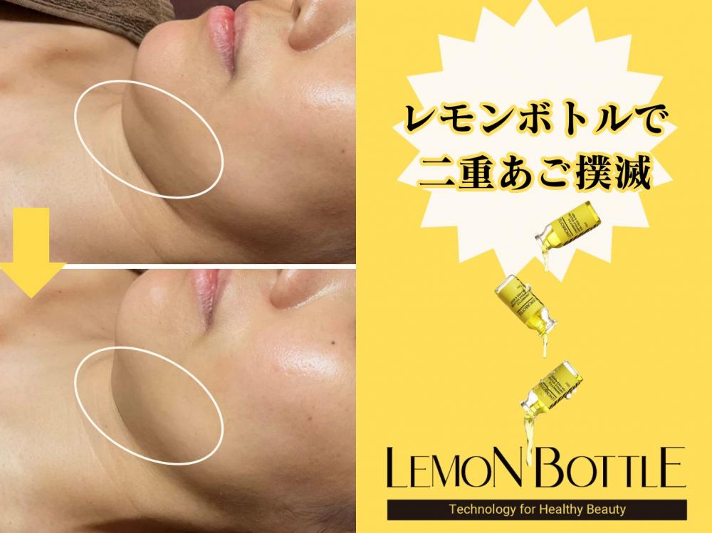小顔×リフトアップ!たるみと脂肪にWでアプローチする最新フェイシャルリフトアップ術