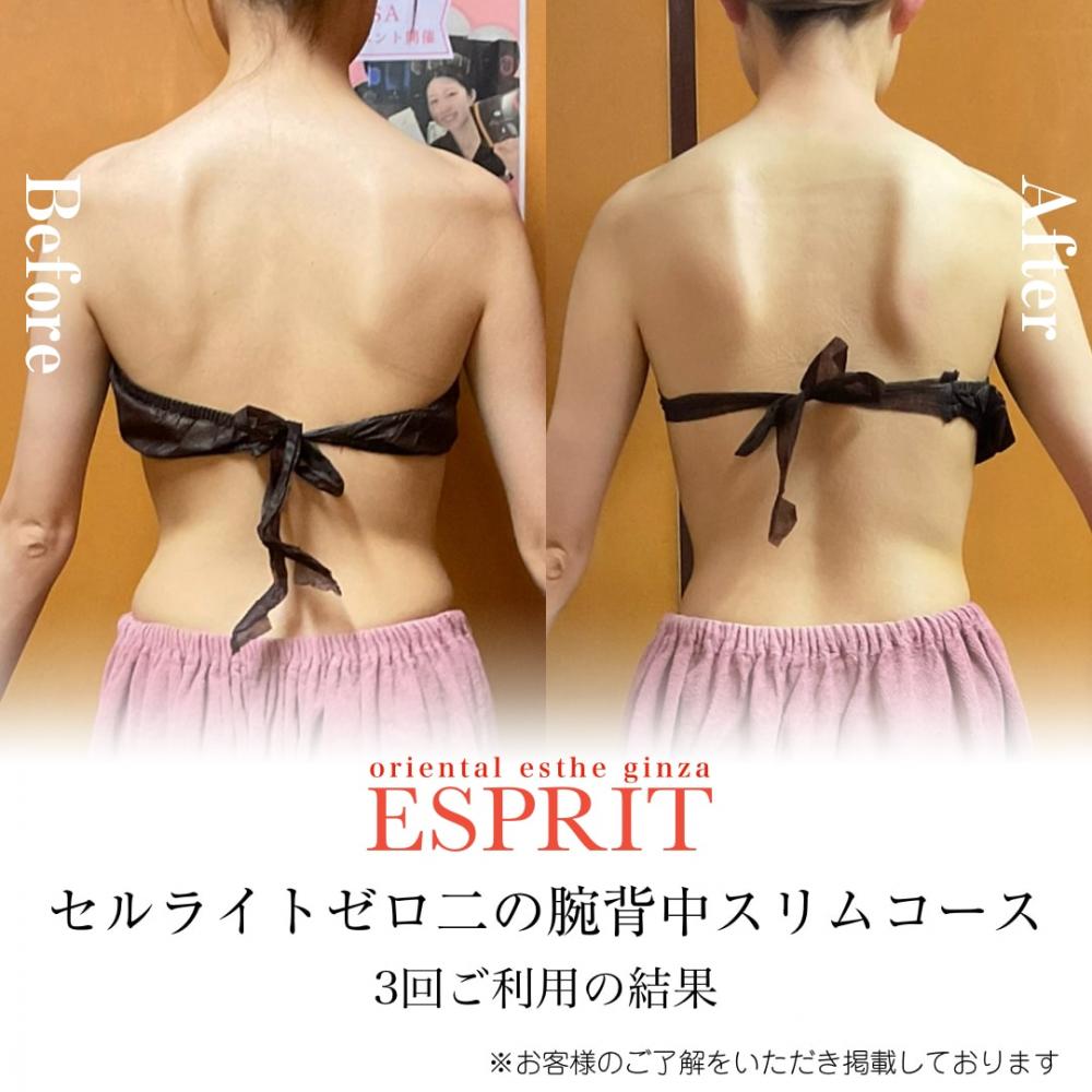 背中のラインがとてもきれいになりました
