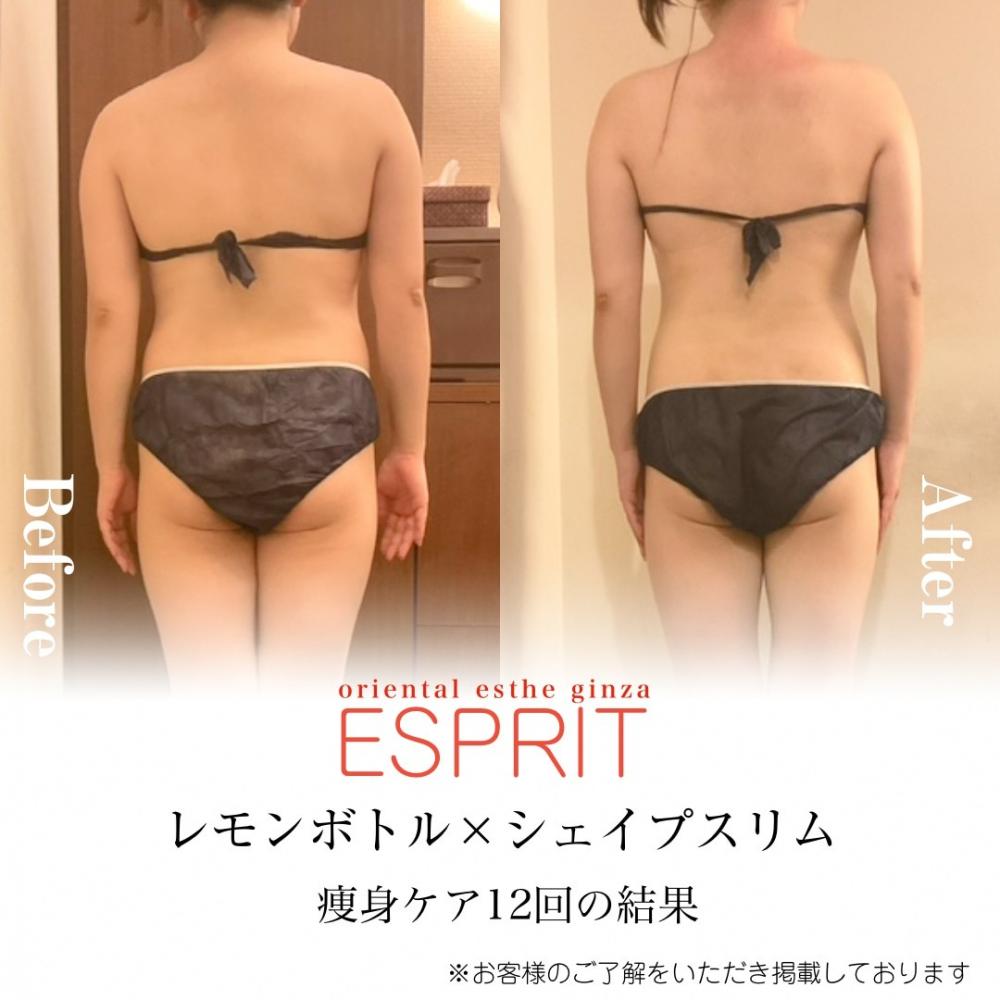 【ブライダルエステ】全身痩せケア事例紹介 