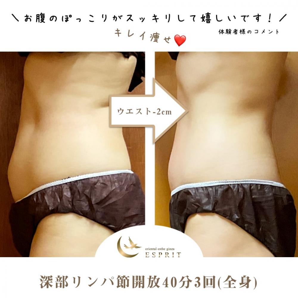ハンド?マシン?どっちが良いの?実際に痩せた人たちが選んだ痩身コースをご紹介!