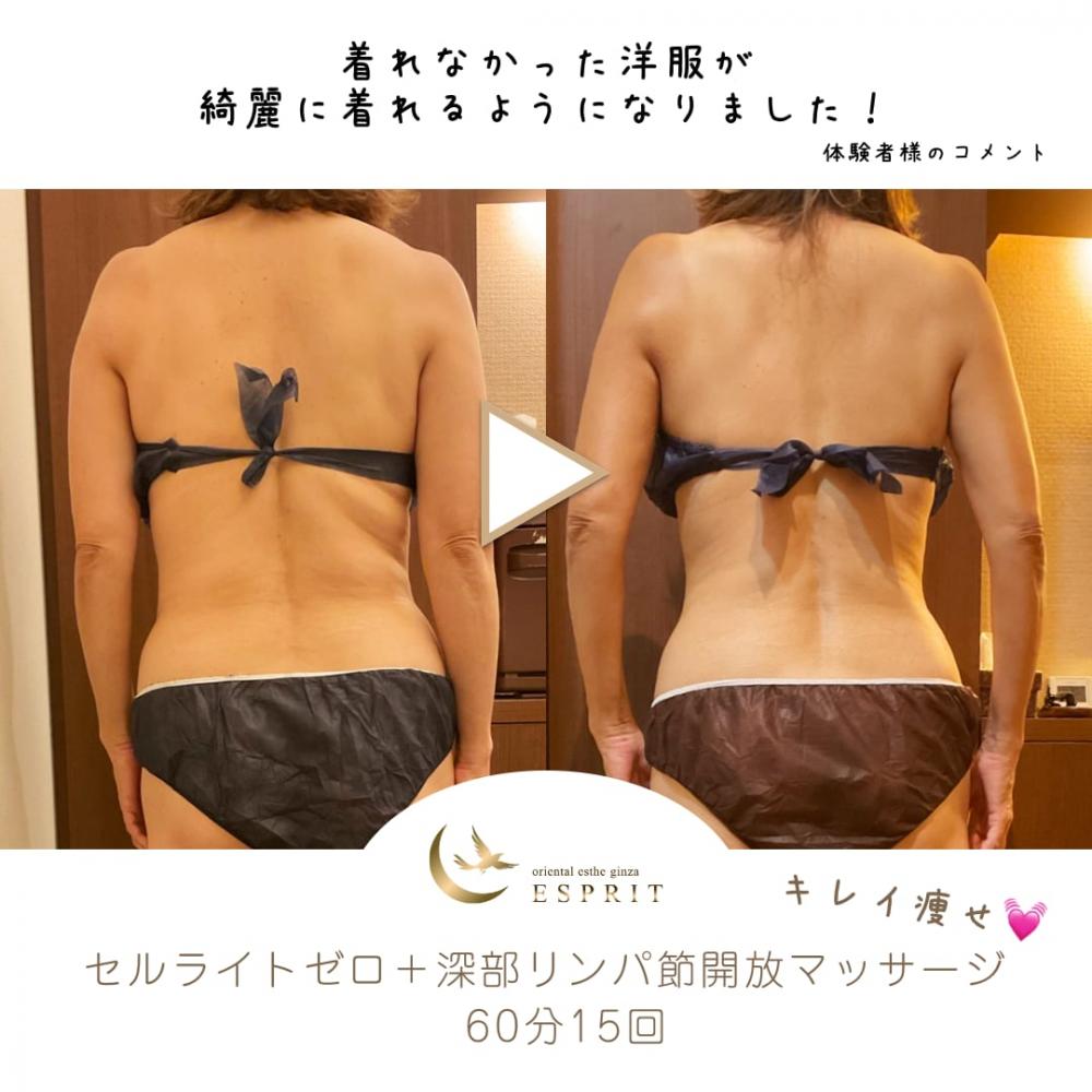 ハンド?マシン?どっちが良いの?実際に痩せた人たちが選んだ痩身コースをご紹介!